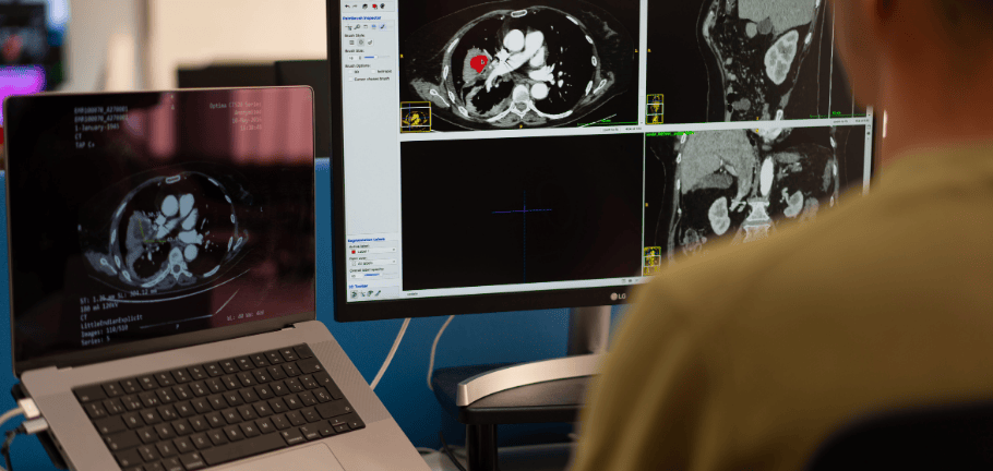 Quibim QP Prostate platform on a laptop and computer screen, showing AI-powered imaging biomarkers.